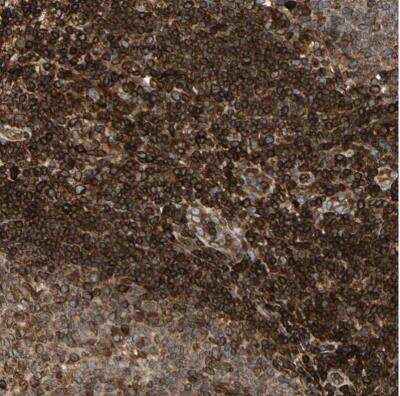 Immunohistochemistry-Paraffin: Tapasin Antibody [NBP1-86968]