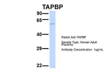 Western Blot: Tapasin Antibody [NBP1-59938]