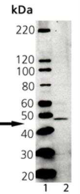 Western Blot: Tapasin Antibody [NBP2-37749]