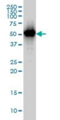 Western Blot: TAPBPR Antibody (6E3) [H00055080-M02]