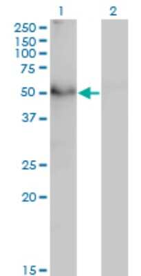 Western Blot: TAPBPR Antibody (6E3) [H00055080-M02]