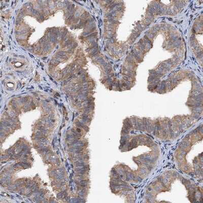 Immunohistochemistry-Paraffin: TAPBPR Antibody [NBP1-87922]