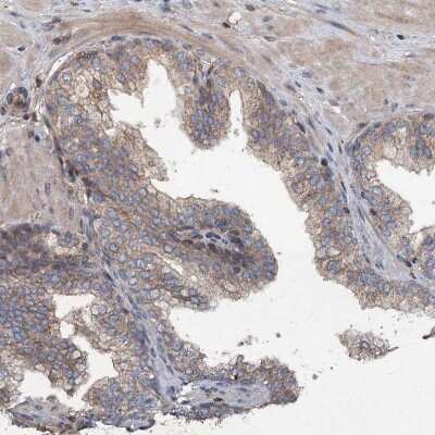 Immunohistochemistry-Paraffin: TAPBPR Antibody [NBP1-87922]