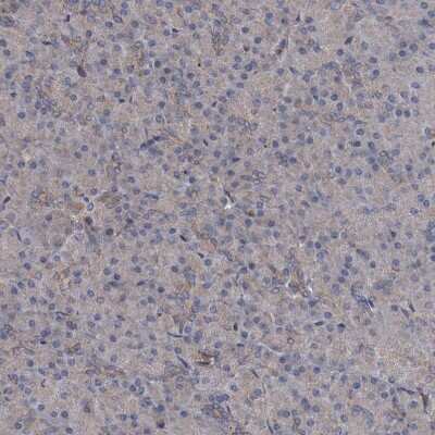 Immunohistochemistry-Paraffin: TAPBPR Antibody [NBP1-87922]