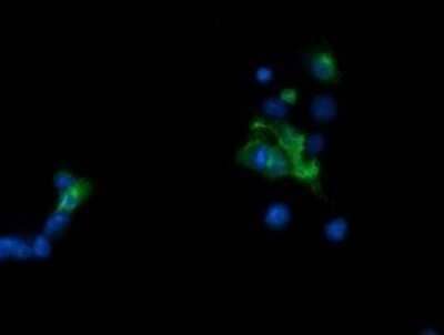 Immunocytochemistry/ Immunofluorescence: TAPBPR Antibody (OTI4H5) - Azide and BSA Free [NBP2-74443]