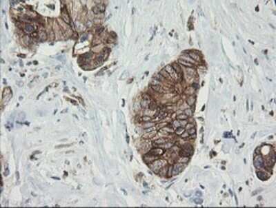Immunohistochemistry: TAPBPR Antibody (OTI4H5) - Azide and BSA Free [NBP2-74443]