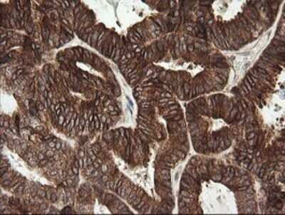 Immunohistochemistry: TAPBPR Antibody (OTI4H5) - Azide and BSA Free [NBP2-74443]