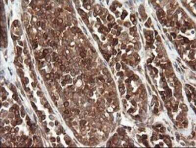 Immunohistochemistry: TAPBPR Antibody (OTI4H5) - Azide and BSA Free [NBP2-74443]