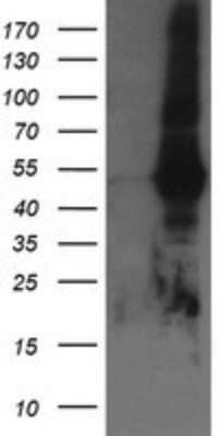 Western Blot: TAPBPR Antibody (OTI4H5)Azide and BSA Free [NBP2-74443]