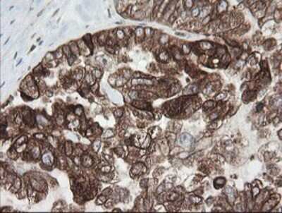 Immunohistochemistry: TAPBPR Antibody (OTI4H5) [NBP2-46066]