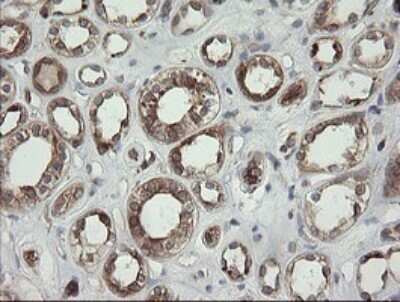 Immunohistochemistry: TAPBPR Antibody (OTI4H5) [NBP2-46066]