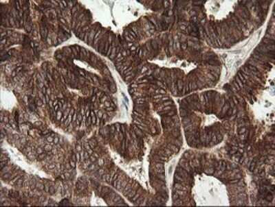 Immunohistochemistry: TAPBPR Antibody (OTI4H5) [NBP2-46066]