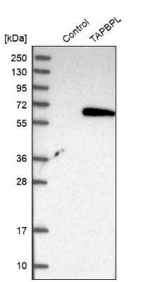 Western Blot: TAPBPR Antibody [NBP1-87922]