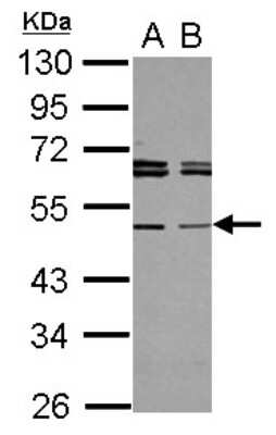 Western Blot: TAPBPR Antibody [NBP2-20565]