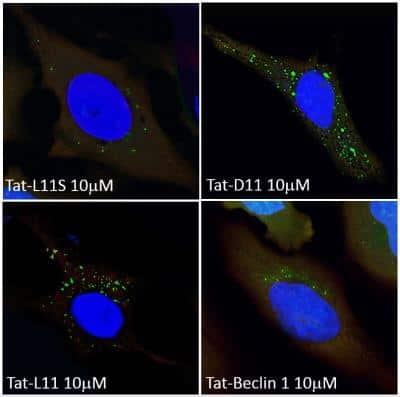 Immunocytochemistry/ Immunofluorescence: Tat-Beclin 1 D11 Autophagy Inducing Peptide - Retroinverso form [NBP2-49888]