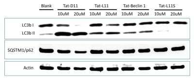 Western Blot: Tat-Beclin 1 L11S PeptideScrambled Control [NBP2-49887]