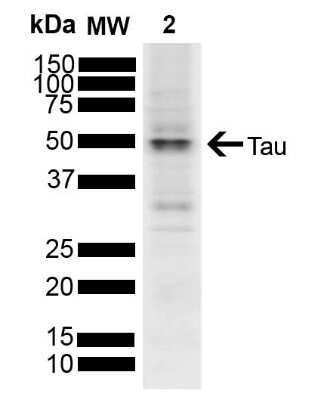 Western Blot: Tau Antibody [NBP3-18238]