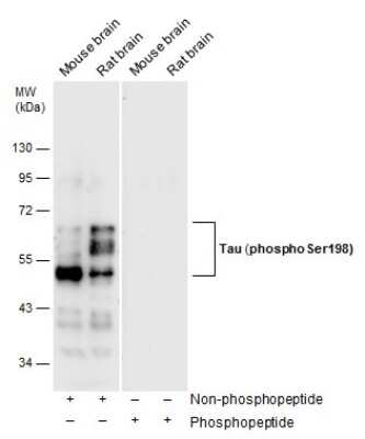 Western Blot: Tau [p Ser198] Antibody [NBP3-12927]