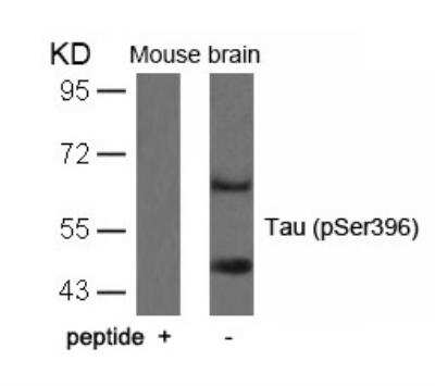 Western Blot: Tau [p Ser396] Antibody [NB100-82243]