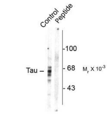 Western Blot: Tau [p Ser416] Antibody [NB110-93503]