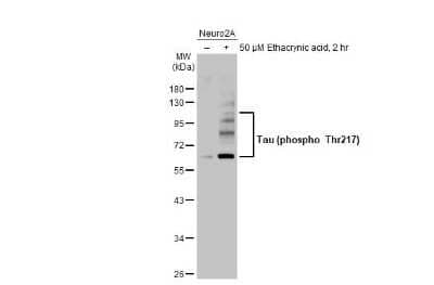 Western Blot: Tau [p Thr217] Antibody [NBP3-13481]