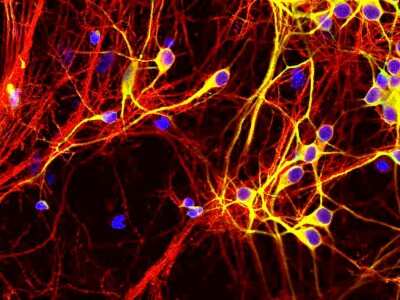 Immunocytochemistry/ Immunofluorescence: Tau Antibody (5B10) [NBP2-50051]