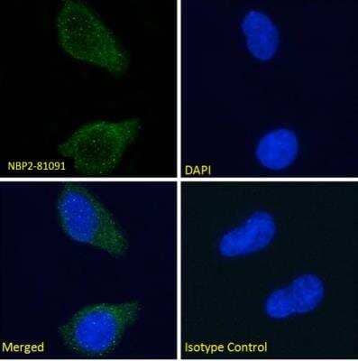 Immunocytochemistry/ Immunofluorescence: Tau Antibody (Tau-5) - Chimeric - Azide and BSA Free [NBP2-81091]