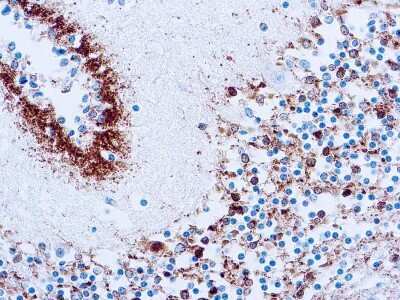 Immunohistochemistry-Paraffin: Tau Antibody (Tau46) [NBP2-42223]