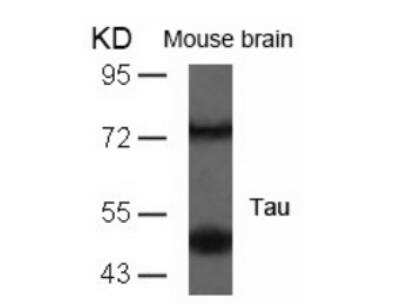 Western Blot: Tau Antibody [NB100-82236]