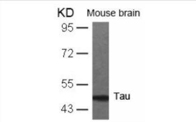 Western Blot: Tau Antibody [NB100-82247]