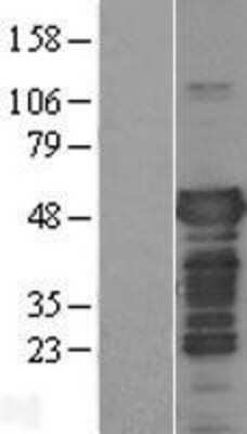 Western Blot: Tau Overexpression Lysate [NBL1-12895]