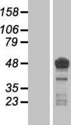 Western Blot: Tau Overexpression Lysate [NBP2-06994]