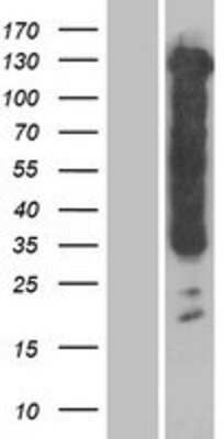 Western Blot: Tau Overexpression Lysate [NBP2-11274]