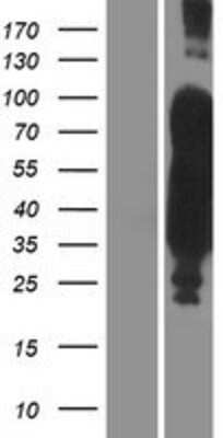 Western Blot: Tau Overexpression Lysate [NBP2-11394]