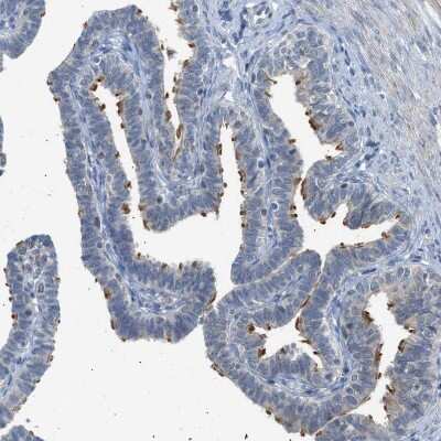 Immunohistochemistry-Paraffin: Tau tubulin kinase 2 Antibody [NBP1-92476]