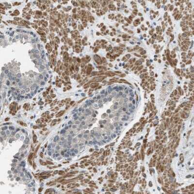 Immunohistochemistry-Paraffin: Tau tubulin kinase 2 Antibody [NBP1-92476]
