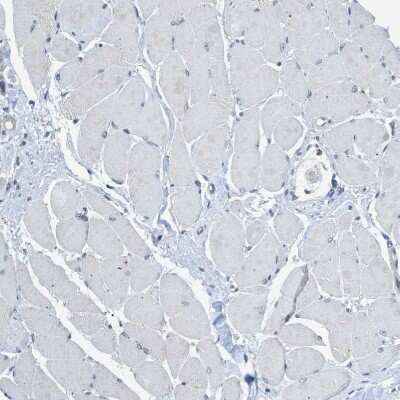 Immunohistochemistry-Paraffin: Tau tubulin kinase 2 Antibody [NBP1-92476]