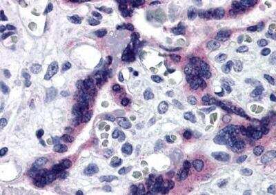 Immunohistochemistry-Paraffin: Tau tubulin kinase 2 Antibody - BSA Free [NBP2-41097]