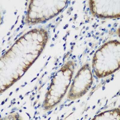Immunohistochemistry-Paraffin: Tau tubulin kinase 2 Antibody - BSA Free [NBP2-93385]