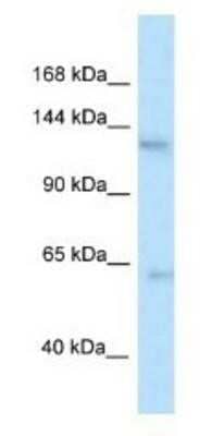 Western Blot: Tau tubulin kinase 2 Antibody [NBP1-82388]