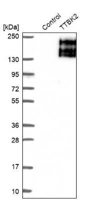 Western Blot: Tau tubulin kinase 2 Antibody [NBP1-92476]