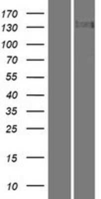 Western Blot: Tau tubulin kinase 2 Overexpression Lysate [NBP2-05134]