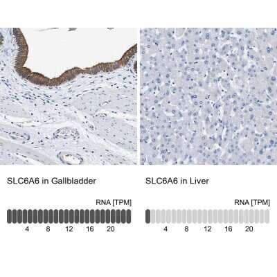 Immunohistochemistry-Paraffin: TauT/SLC6A6 Antibody [NBP1-86964]