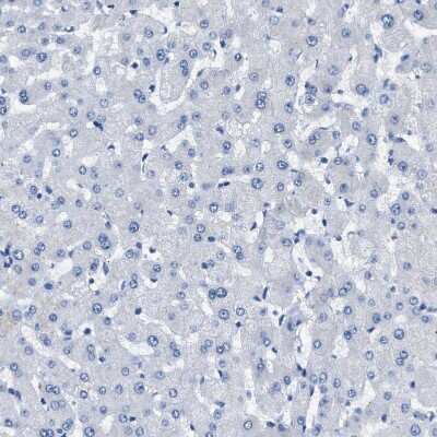 Immunohistochemistry-Paraffin: TauT/SLC6A6 Antibody [NBP1-86964]