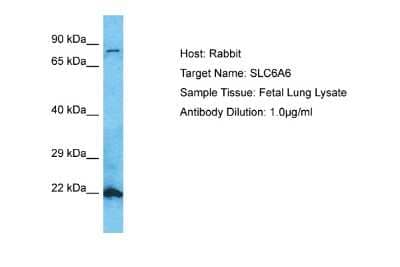 Western Blot: TauT/SLC6A6 Antibody [NBP2-85875]