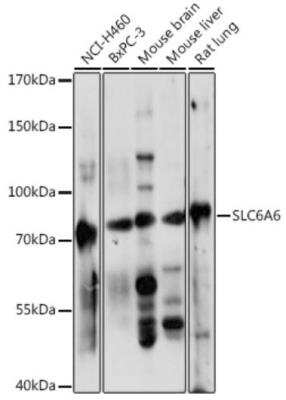 Western Blot: TauT/SLC6A6 AntibodyAzide and BSA Free [NBP2-93858]