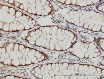 Immunohistochemistry-Paraffin: Tbp7 Antibody (3G8) [H00005704-M01]
