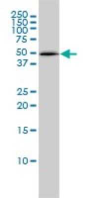 Western Blot: Tbp7 Antibody (3G8) [H00005704-M01]