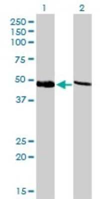 Western Blot: Tbp7 Antibody (3G8) [H00005704-M01]