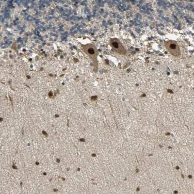 Immunohistochemistry-Paraffin: Tbp7 Antibody [NBP1-87798]